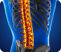 Spinal Fusion Treatment Illustration